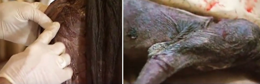 L'ipoderma del "chupacabra" era sano (sinistra)... ma la scabbia colpisce l'epidermide (destra)